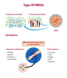 Anaerobic Mrsa Debunking The Myths Facts - 9g6nnlh