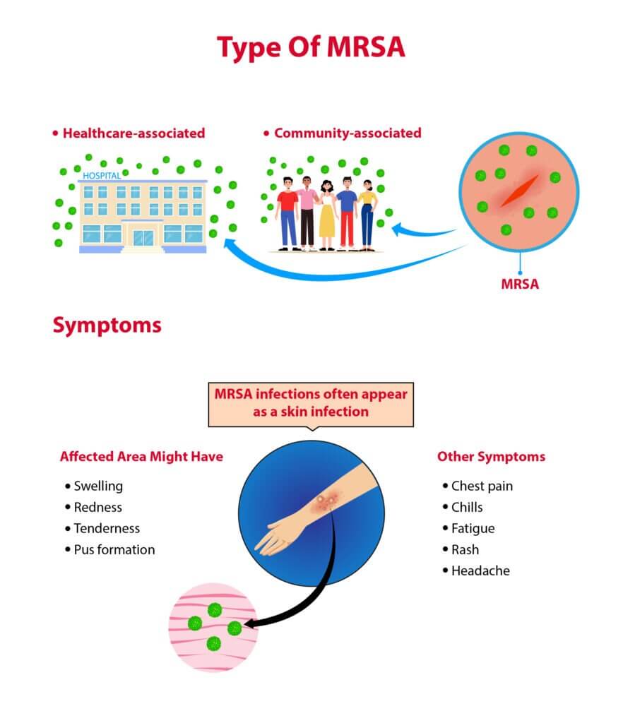 MRSA Facts, Symptoms, & Prevention Tips