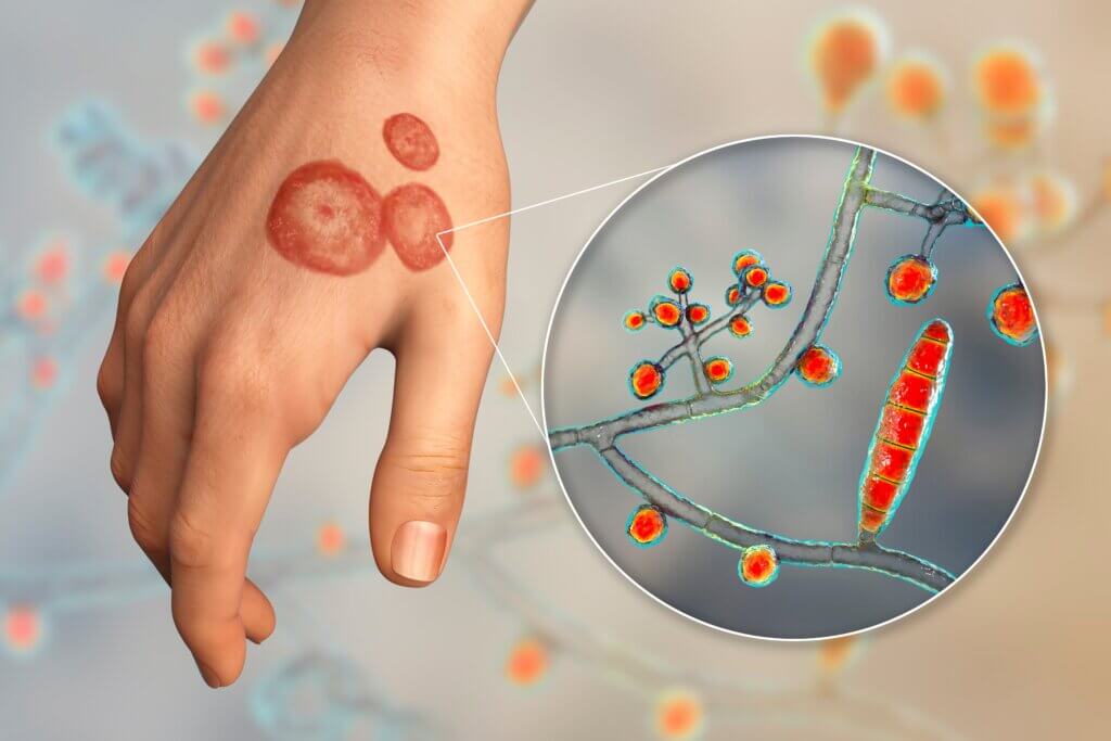 Trichophyton mentagrophytes in Cosmetics