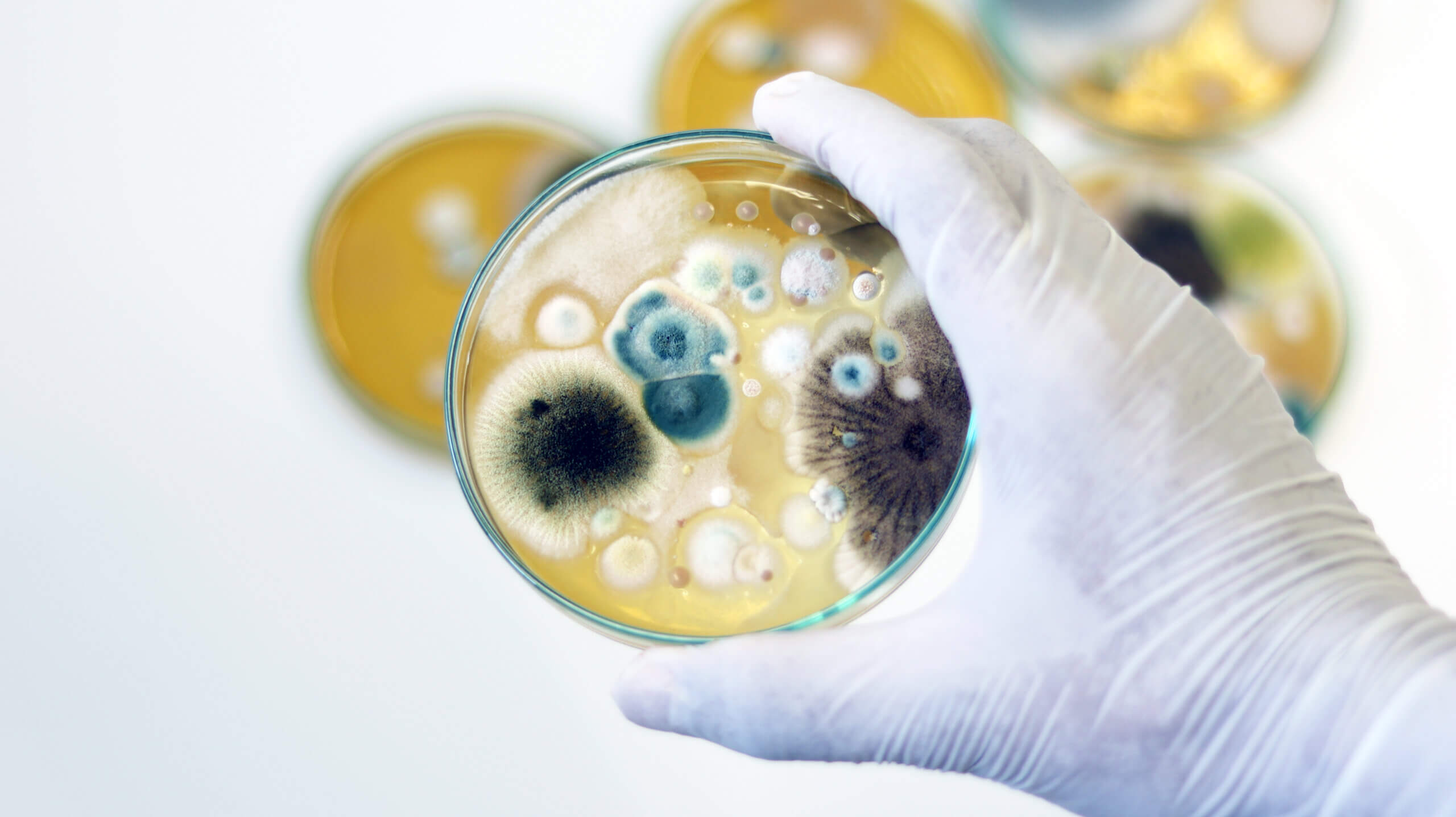 DIY or Professional? Understanding Fungal Testing Kits for Home and Lab