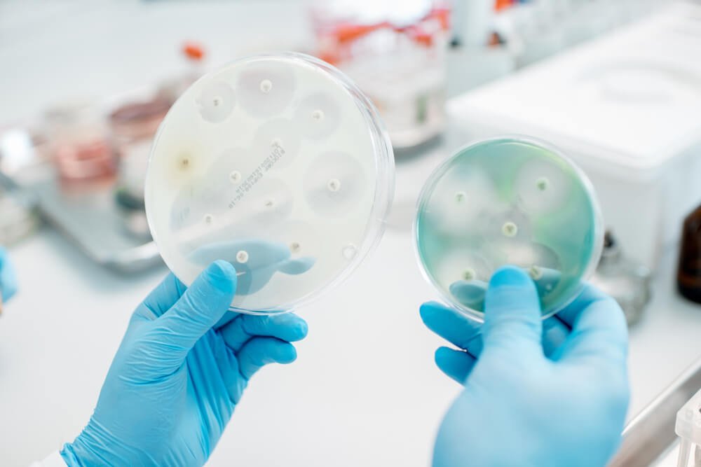 Image of ZOI testing of antibacterial agents showing clear zone of inhibition