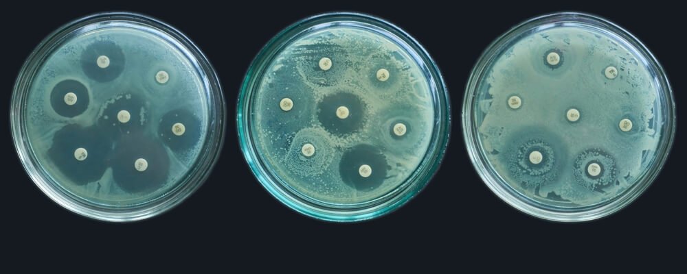 Image of antimicrobial tests performed by drug developers. ZOI, MIC, MBC