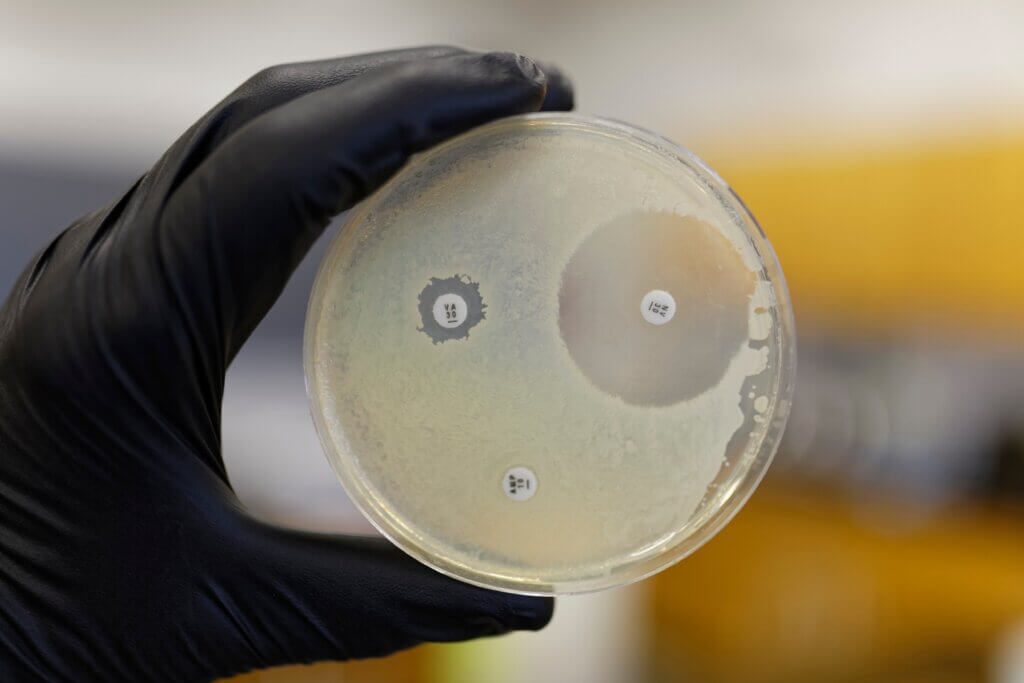 ZOI testing for pathogens