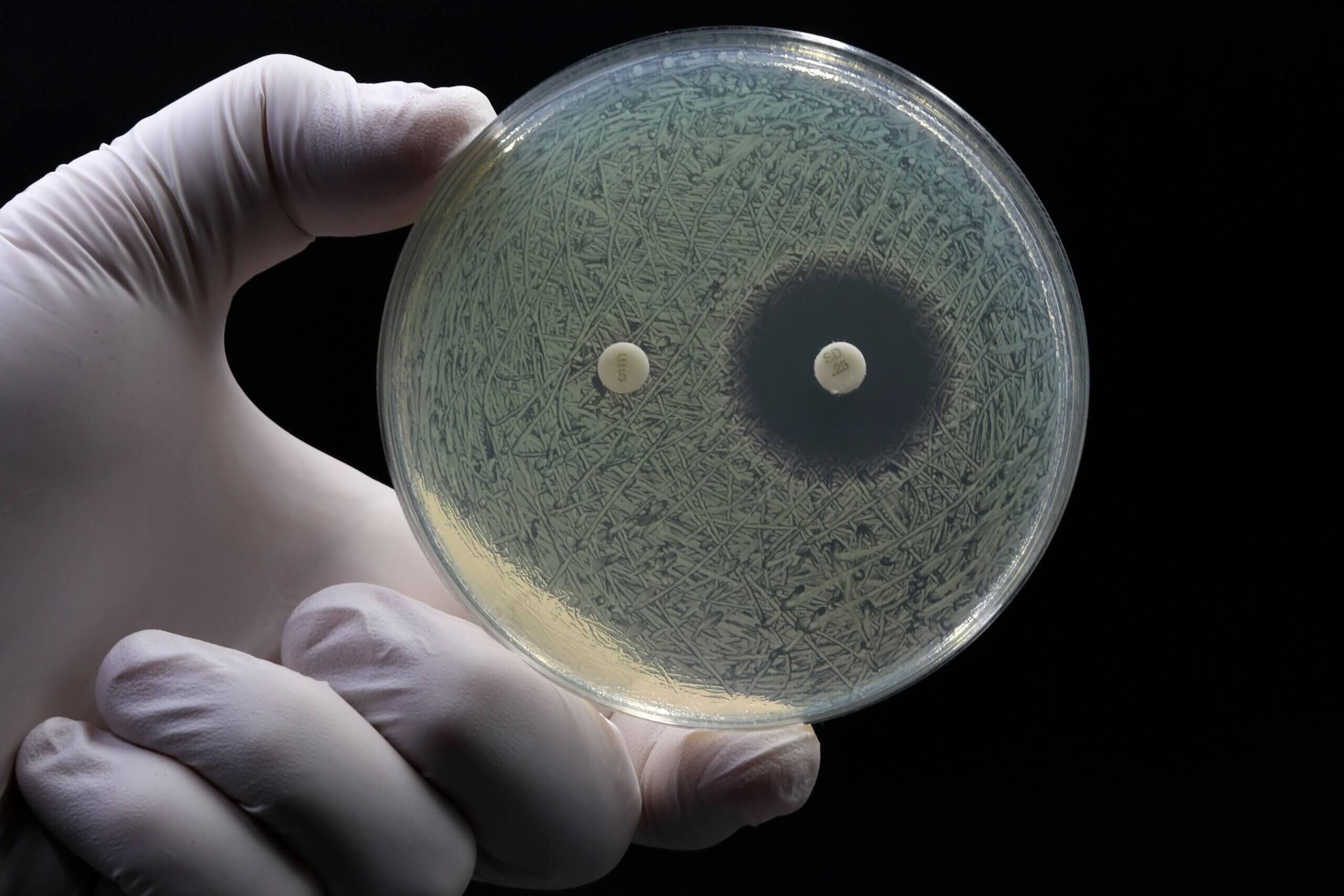 MBC vs. MIC test showing zone of inhibition, information required for drug developers