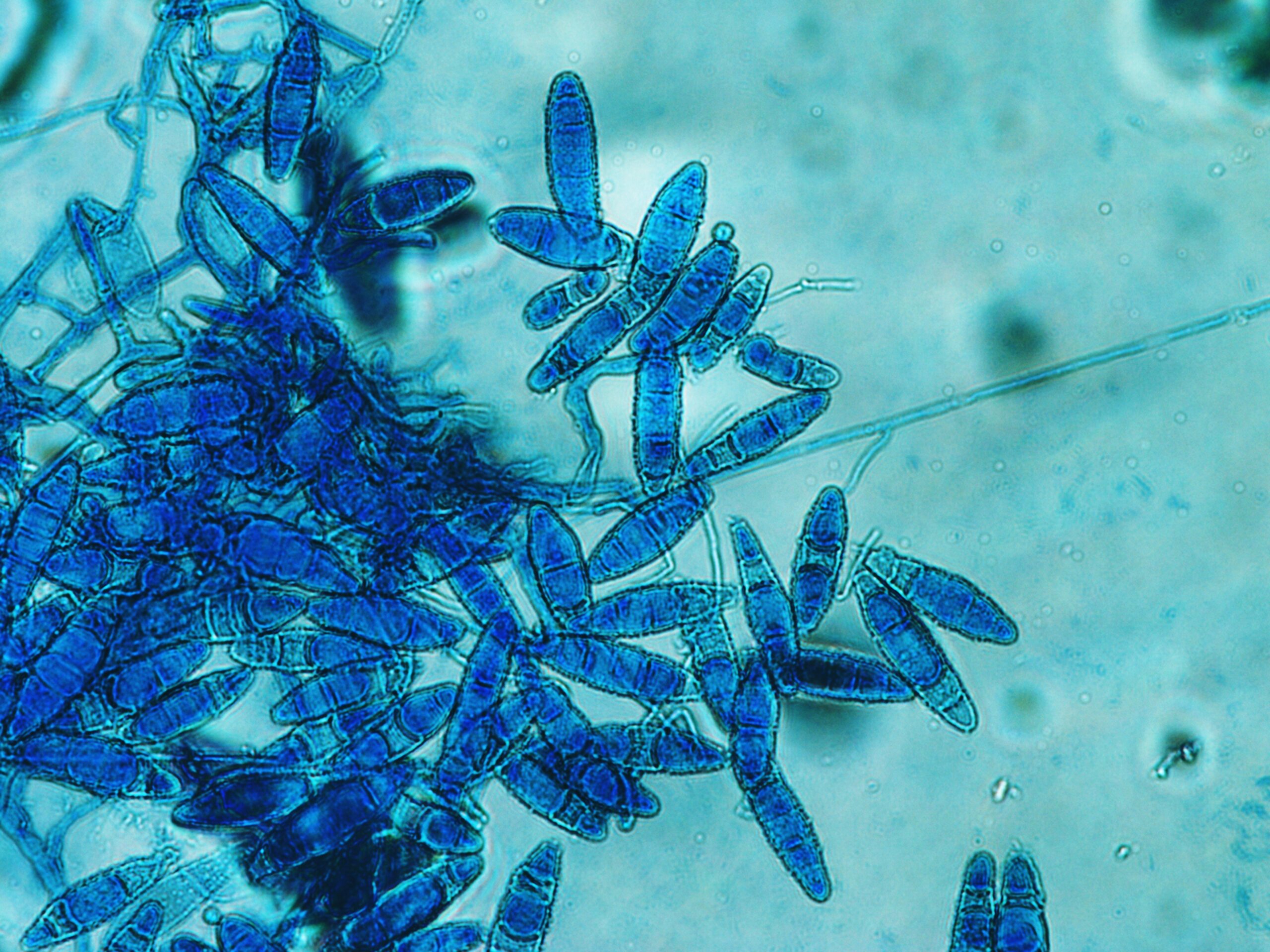 Test for fungal contamination (Trichophyton mentagrophytesTrichophyton mentagrophytes)