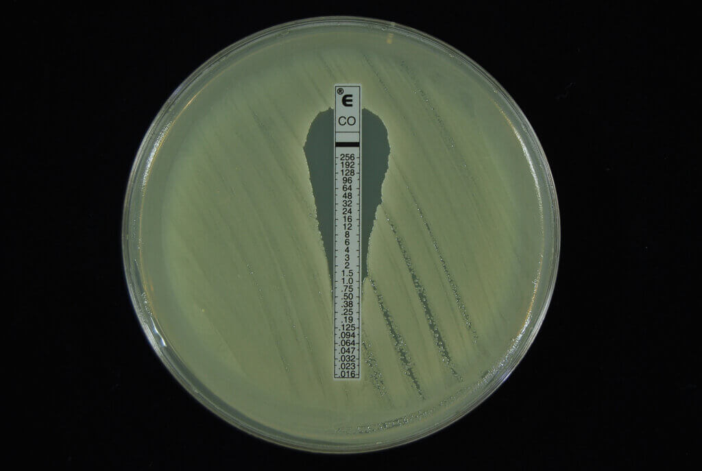 Cost effective approach for drug sensitivity testing