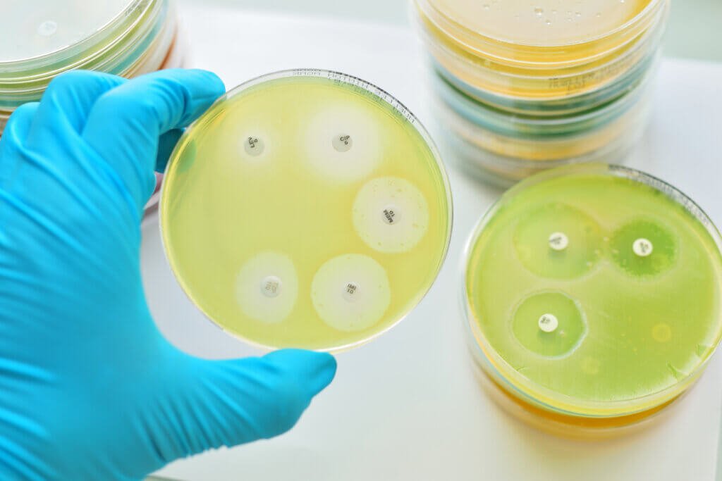 Bacterial resistance testing - MIC,ZOI and MBC