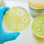 Bacterial resistance testing - MIC,ZOI and MBC