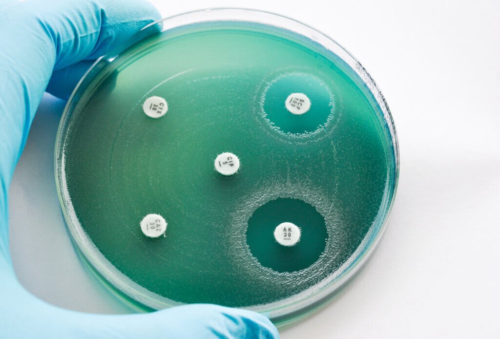 MIC and MBC testing tips with plate showing zone of inhibition for these tests