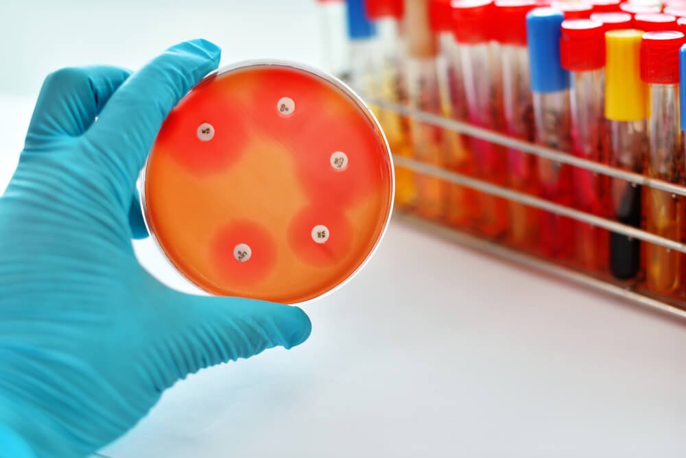 Image of Minimum Bactericidal Concentration test of antibacterial agent