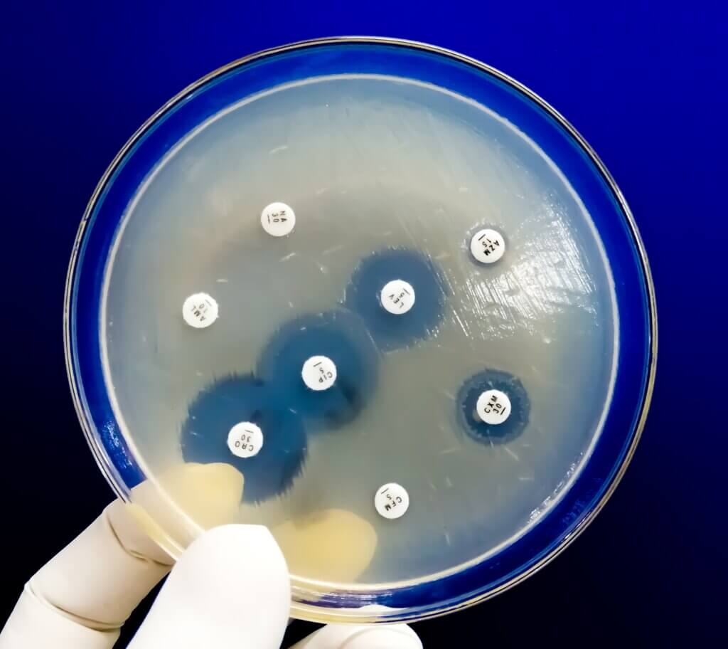 Antimicrobial Samples in petri dish