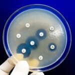 Antimicrobial Samples in petri dish