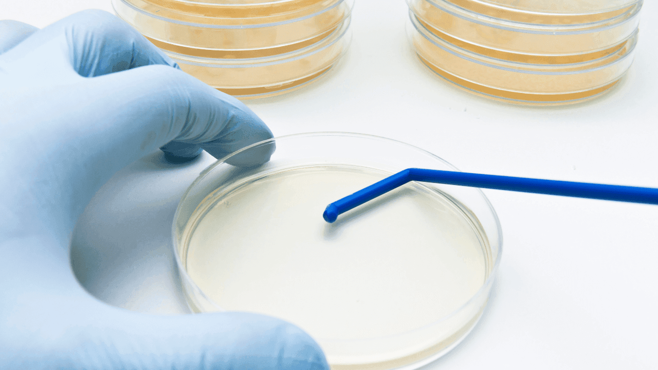 EN 13697 - Disinfectant efficacy testing for bactericidal, fungicidal ...