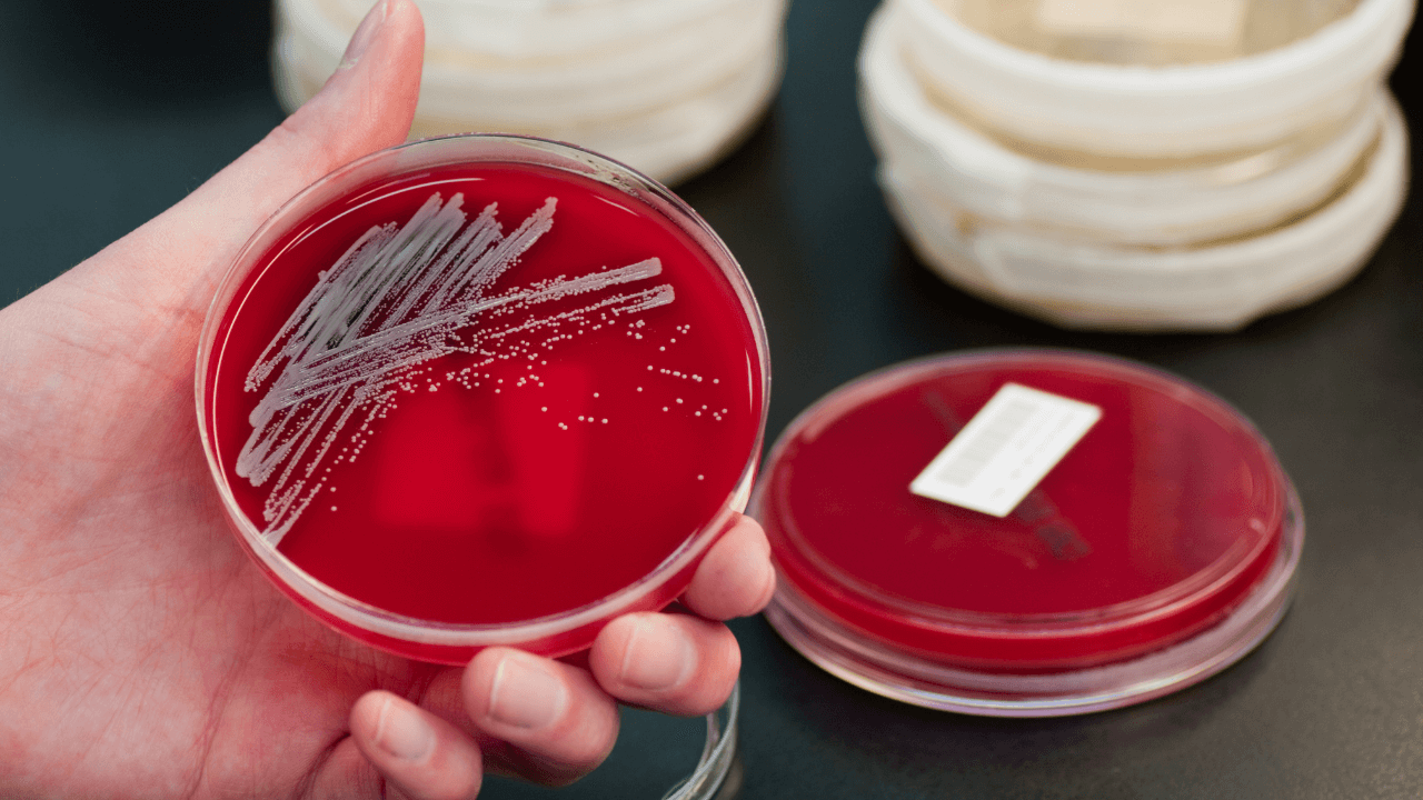 EN 17387 - Test Bactericidal, Yeasticidal, Fungicidal activity of ...