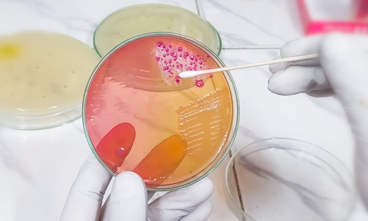 Taking Samples from petri dish