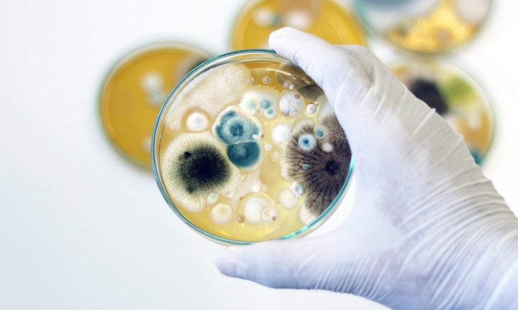 DIY or Professional? Understanding Fungal Testing Kits for Home and Lab