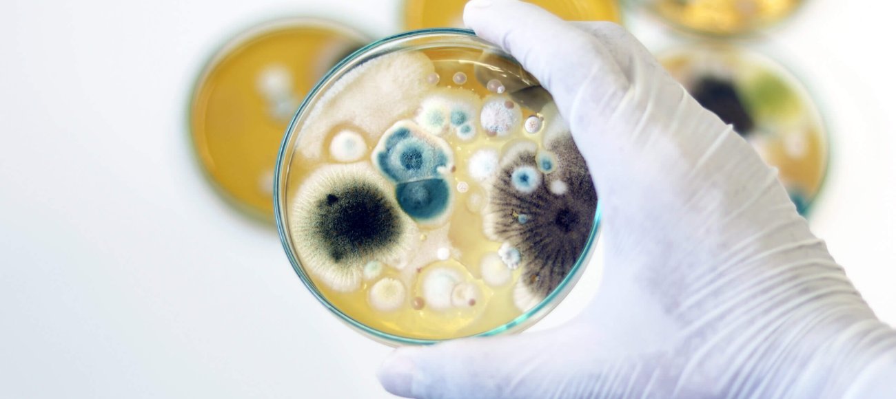 DIY or Professional? Understanding Fungal Testing Kits for Home and Lab