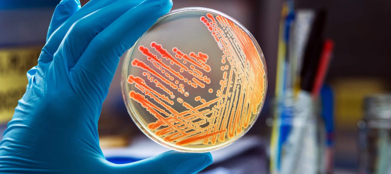 Microbiology - Studying of micro-organisms image