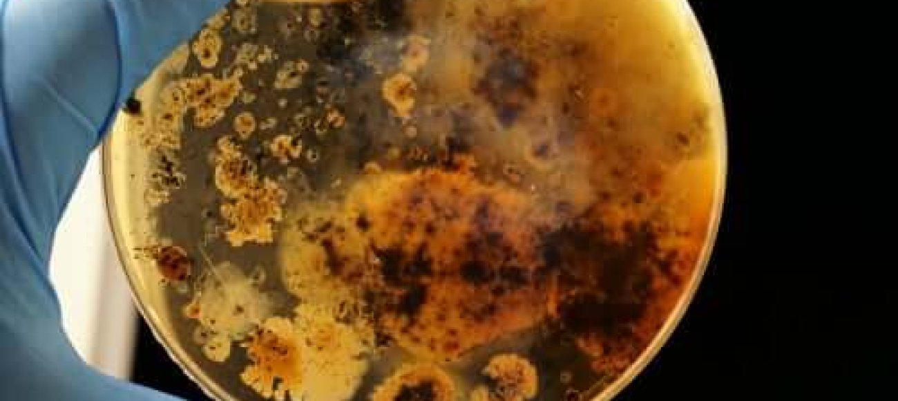 Anitibacterial Testing