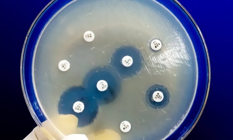 Antimicrobial Samples in petri dish