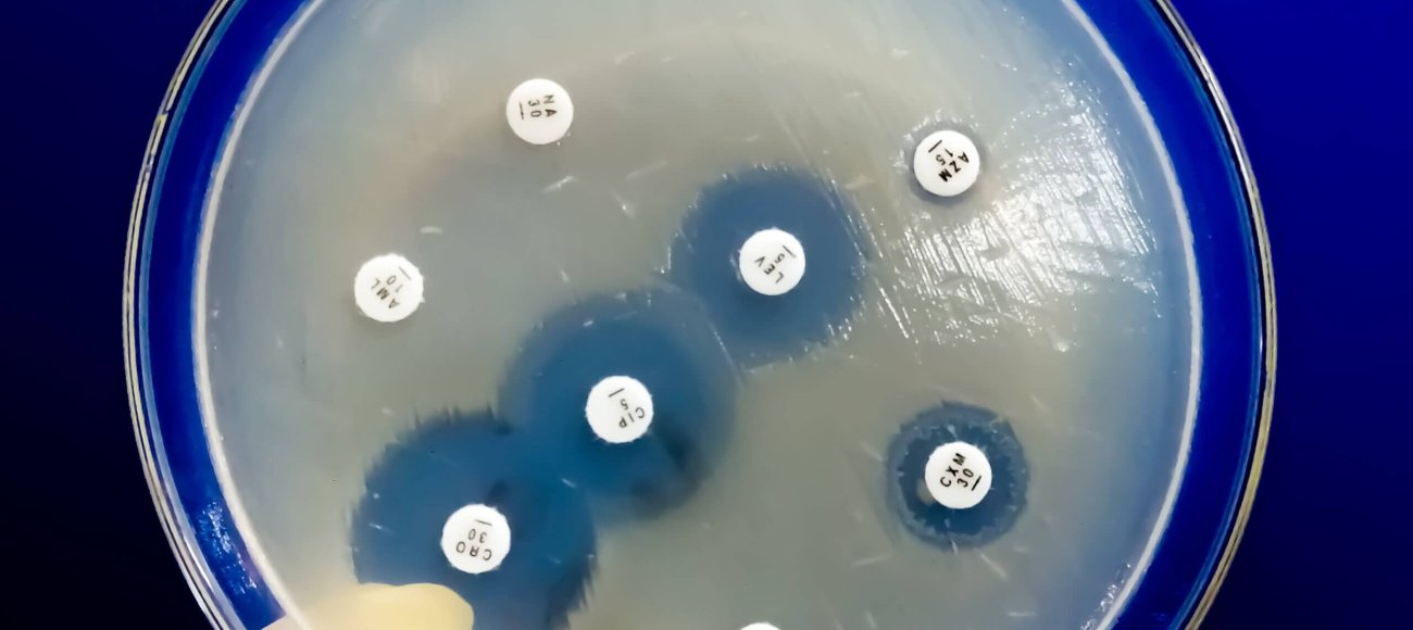 Antimicrobial Samples in petri dish