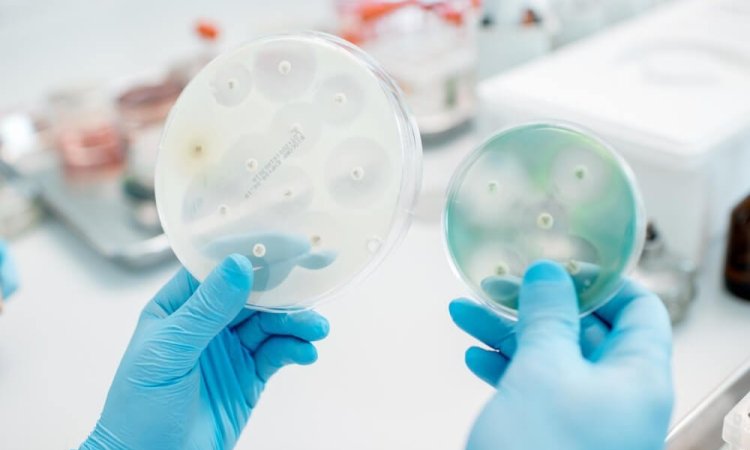 Image of ZOI testing of antibacterial agents showing clear zone of inhibition