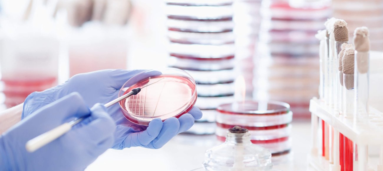 Why test your product as per the EN 14347 standard guidelines?