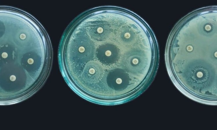 Image of antimicrobial tests performed by drug developers. ZOI, MIC, MBC