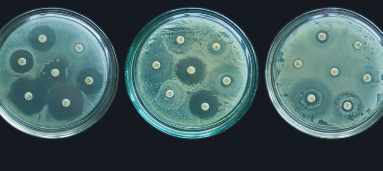 Image of antimicrobial tests performed by drug developers. ZOI, MIC, MBC
