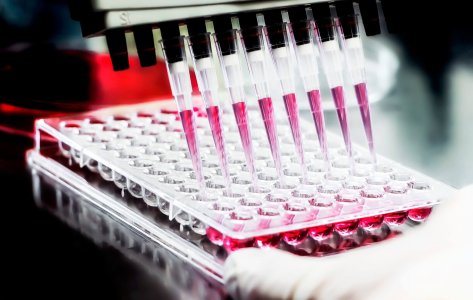 96,Well,Plate,For,Pcr,Processing,,Microbiological,Laboratory.,Researcher,Pipetting