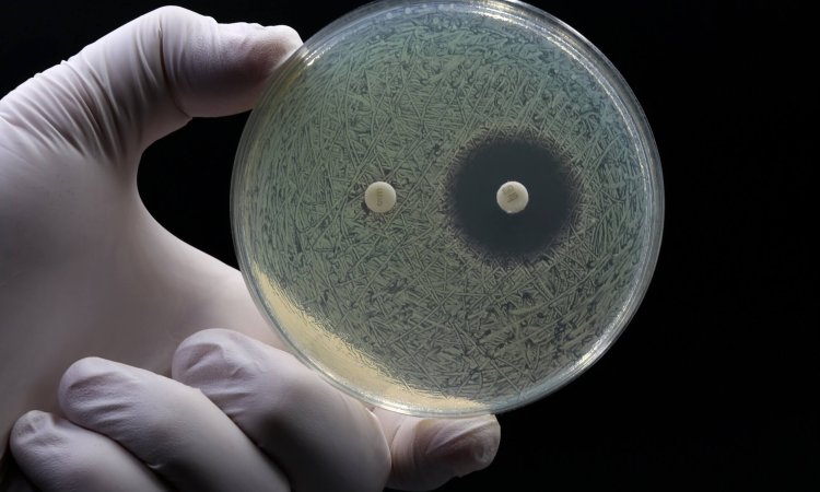 MBC vs. MIC test showing zone of inhibition, information required for drug developers