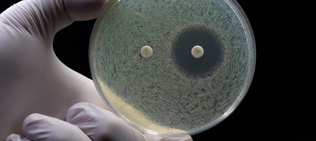 MBC vs. MIC test showing zone of inhibition, information required for drug developers