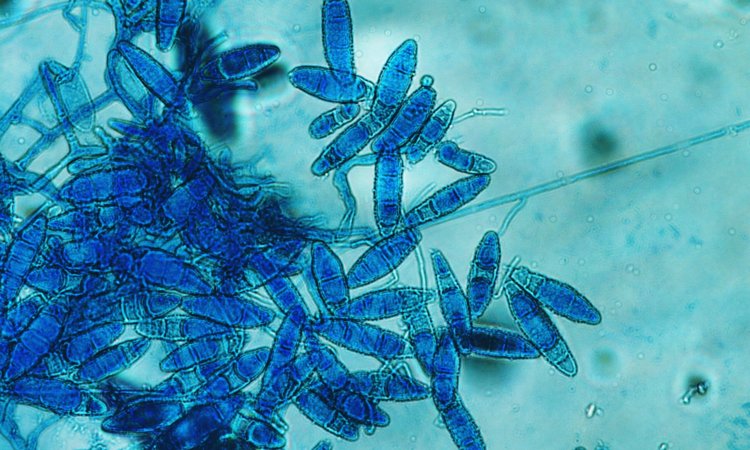 Test for fungal contamination (Trichophyton mentagrophytesTrichophyton mentagrophytes)