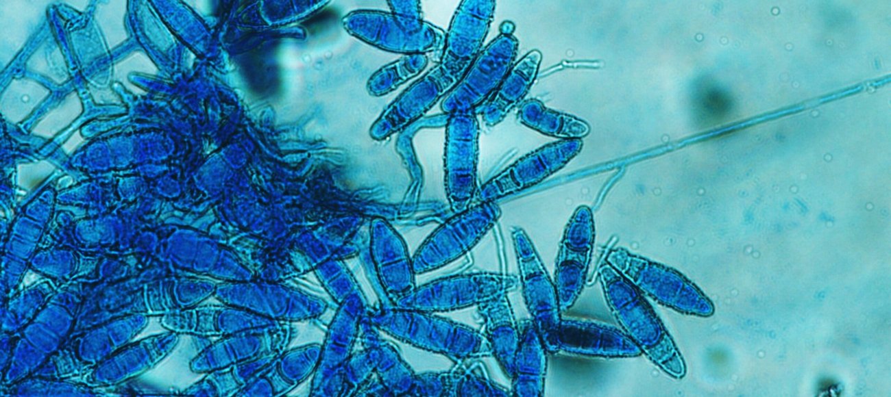 Test for fungal contamination (Trichophyton mentagrophytesTrichophyton mentagrophytes)
