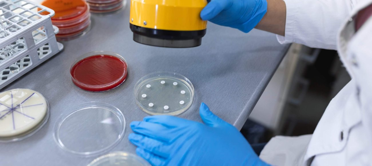 MIC testing for antibiotic dosage