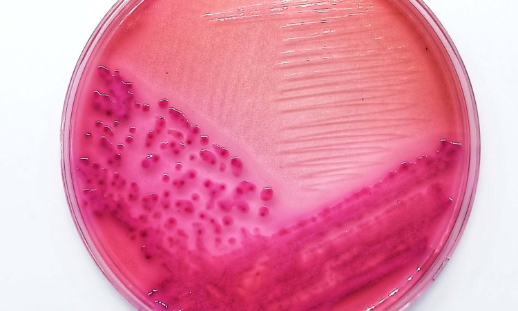 The Emerging Threat: Antimicrobial Resistance in Hypervirulent Klebsiella