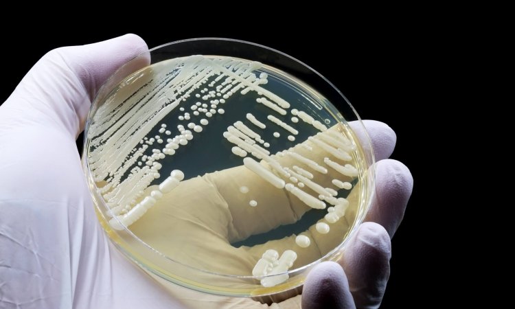 antifungal disinfectant testing against drug-resistant Candida auris