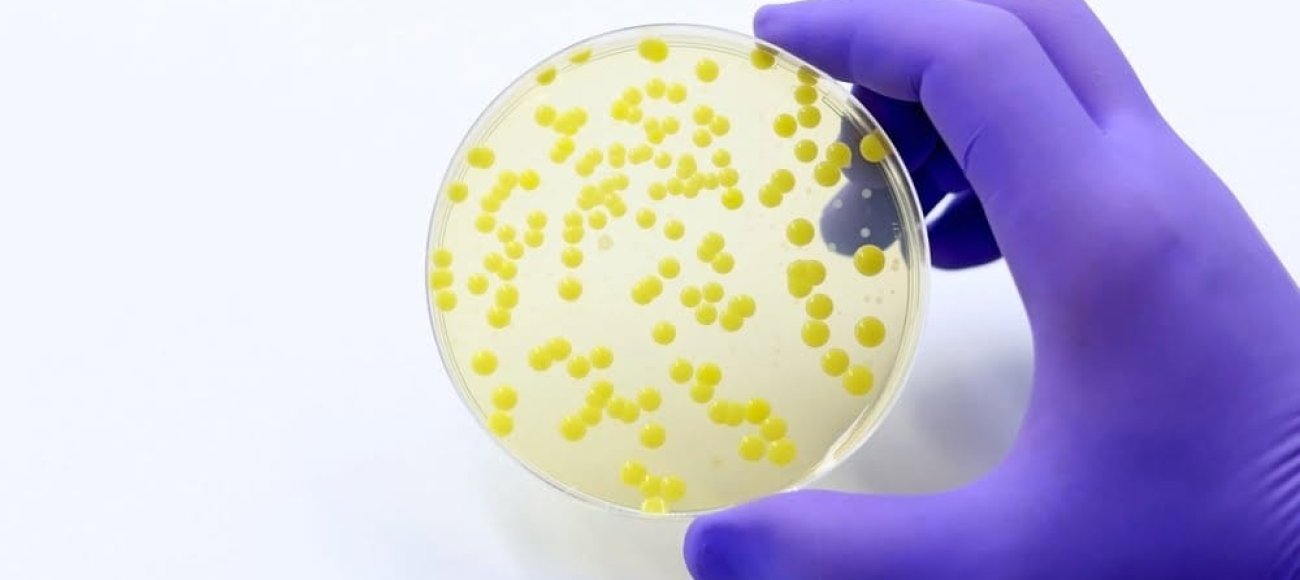 USP 61: Microbial Enumeration Tests