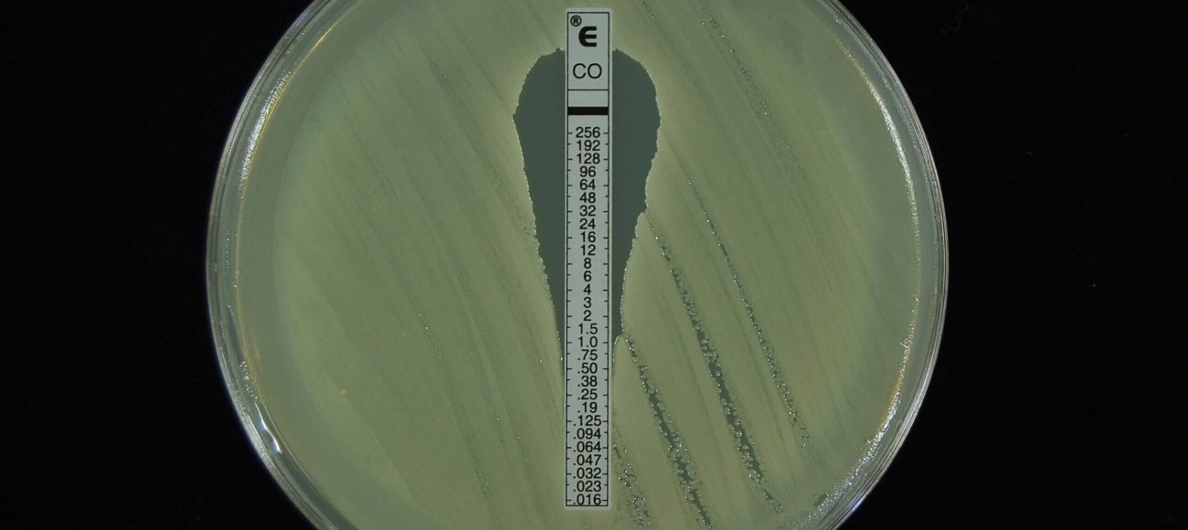 Cost effective approach for drug sensitivity testing