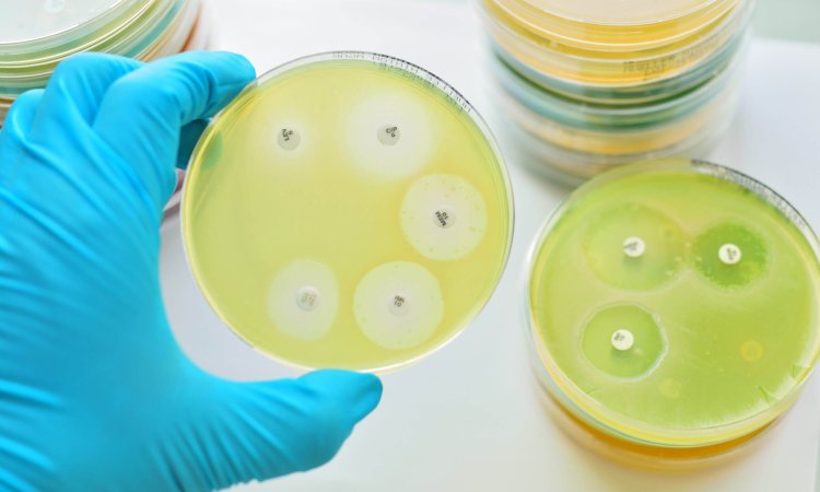 Bacterial resistance testing - MIC,ZOI and MBC