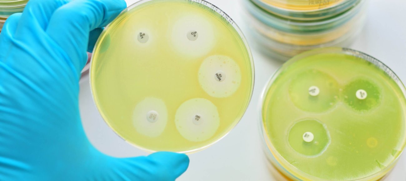 Bacterial resistance testing - MIC,ZOI and MBC