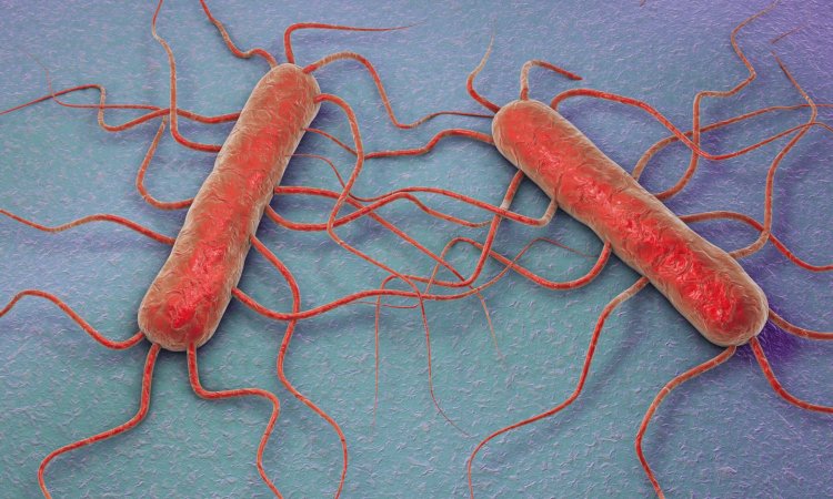 Understanding Listeria Management: Basics and Beyond