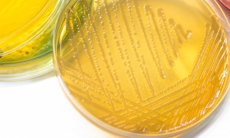 An Overview of USP 62: Testing for Specified Microorganisms