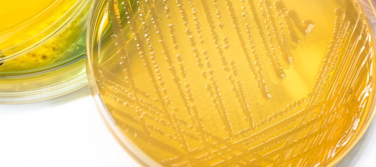 An Overview of USP 62: Testing for Specified Microorganisms