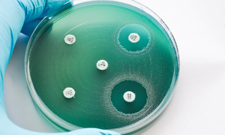 MIC and MBC testing tips with plate showing zone of inhibition for these tests