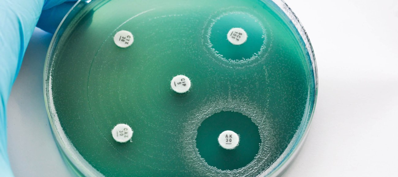 MIC and MBC testing tips with plate showing zone of inhibition for these tests