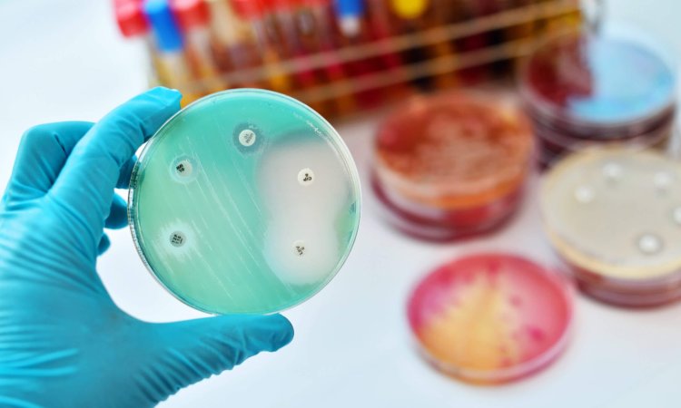 Antimicrobial susceptibility testing in petri dish