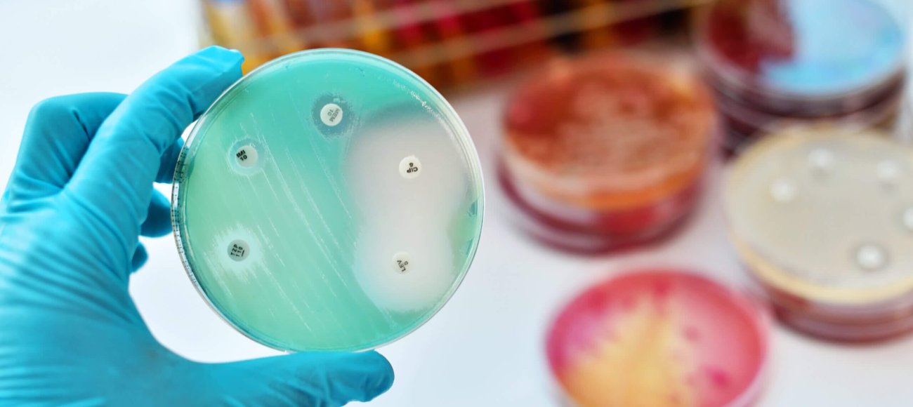 Antimicrobial susceptibility testing in petri dish