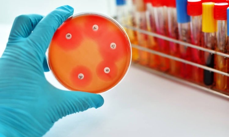 Image of Minimum Bactericidal Concentration test of antibacterial agent