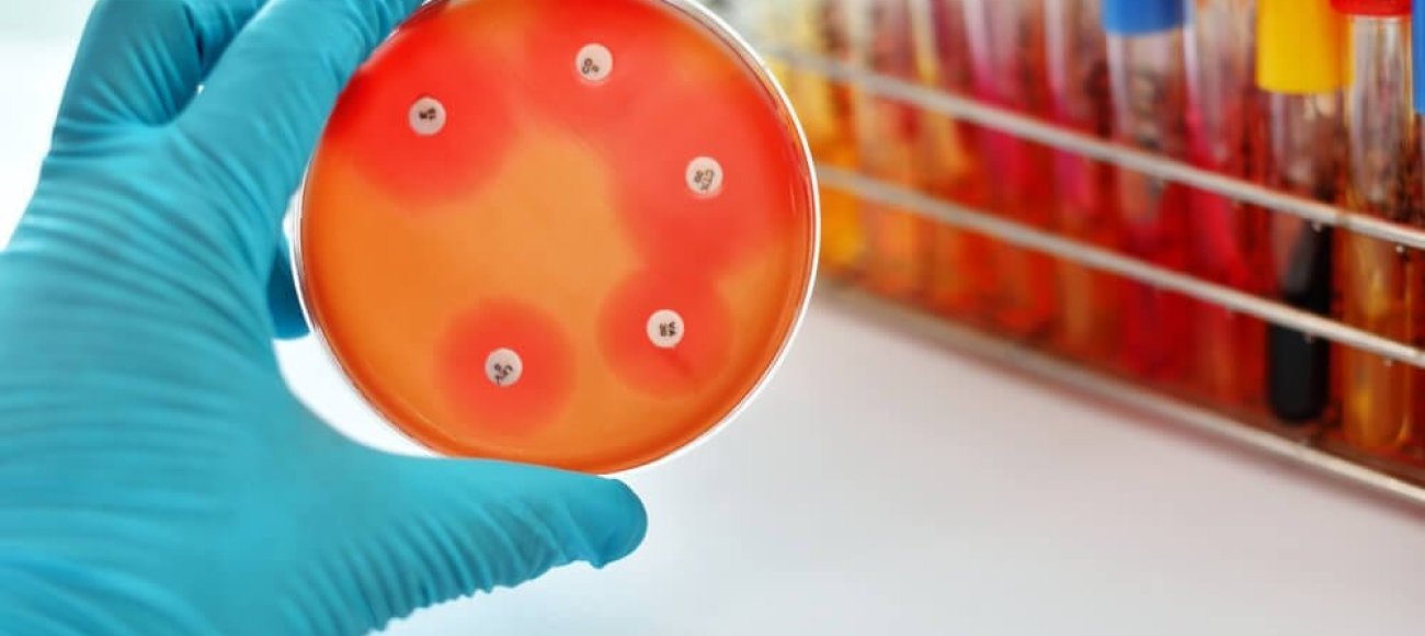 Image of Minimum Bactericidal Concentration test of antibacterial agent